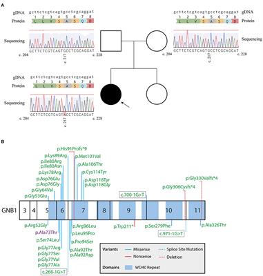 Case Report: A Novel GNB1 Mutation Causes Global Developmental Delay With Intellectual Disability and Behavioral Disorders